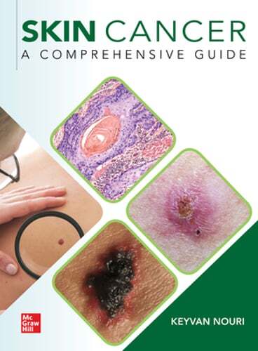 Skin Cancer: A Comprehensive Guide by Keyvan Nouri: New