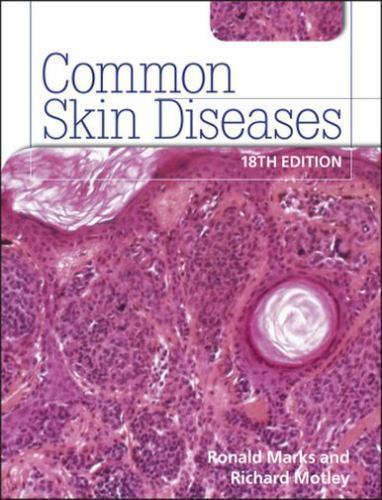 Common Skin Diseases 18th Edition: Ise by Marks, Ronald; Motley, Richard