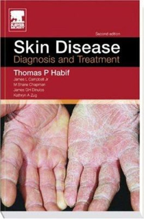 Skin Disease : Diagnosis and Treatment Paperback