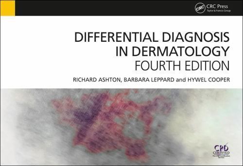 Differential Diagnosis in Dermatology 4th Edition by Ashton, Leppard