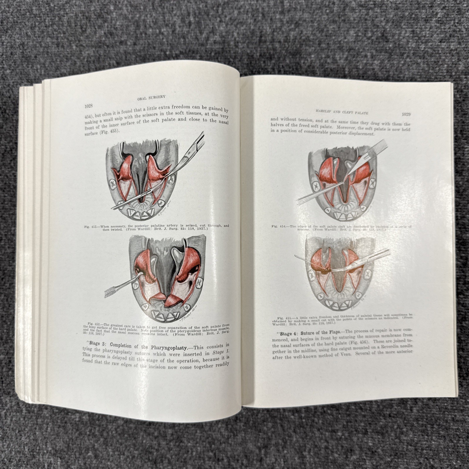 Oral Surgery by Sterling V. Mead Vintage 2nd Edition Hardcover Textbook 1940