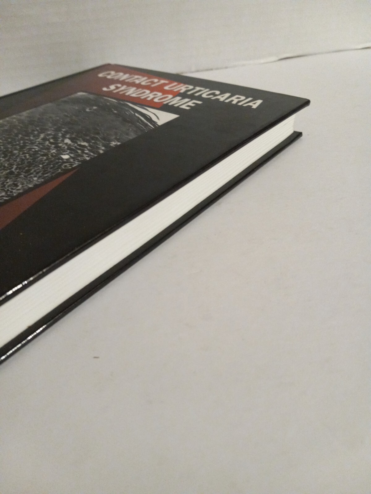Contact Urticaria Syndrome (Dermatology: Clinical & Basic Science) 1997