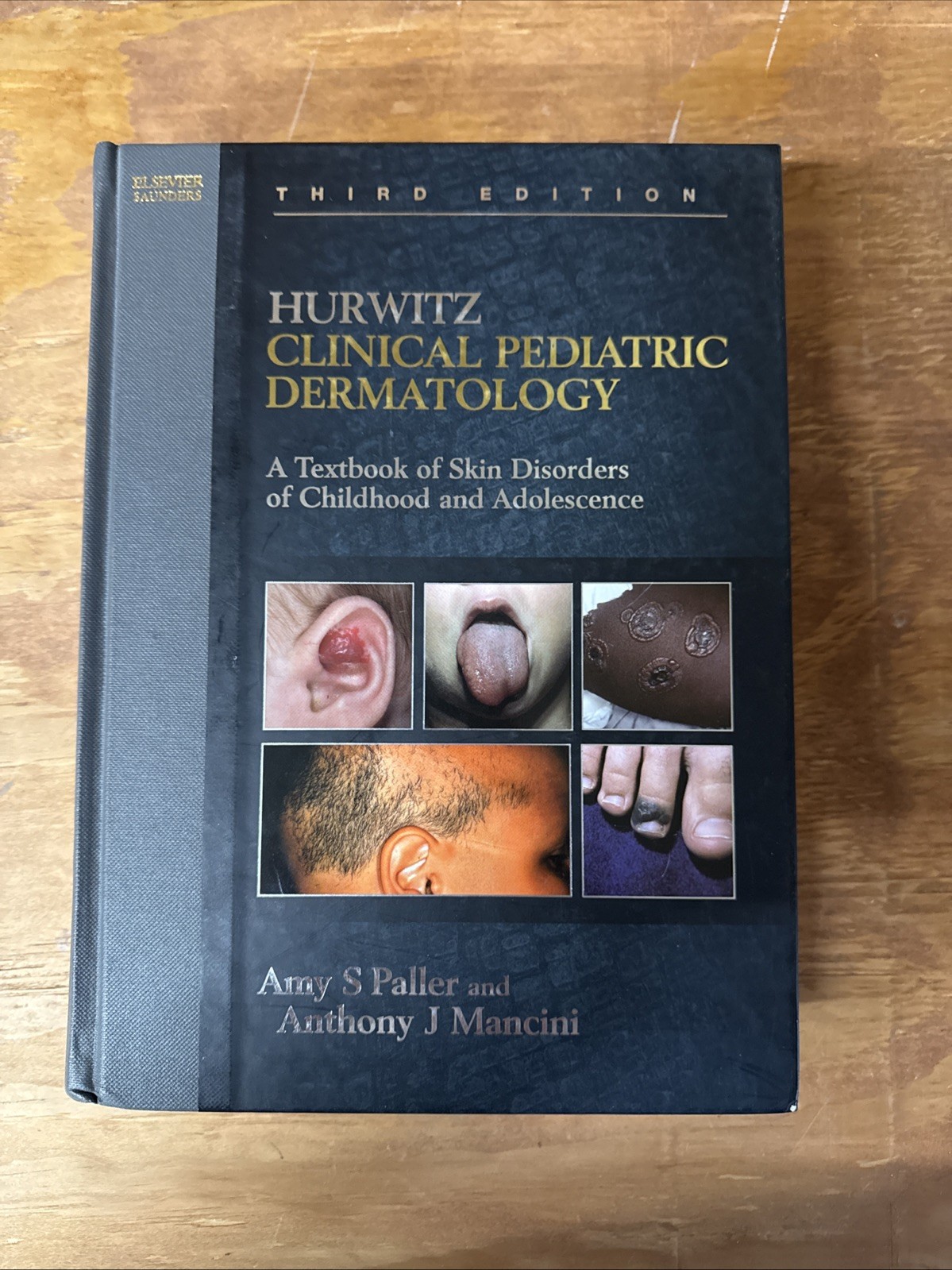 Hurwitz Clinical Pediatric Dermatology: A Textbook of Skin Disorders of…