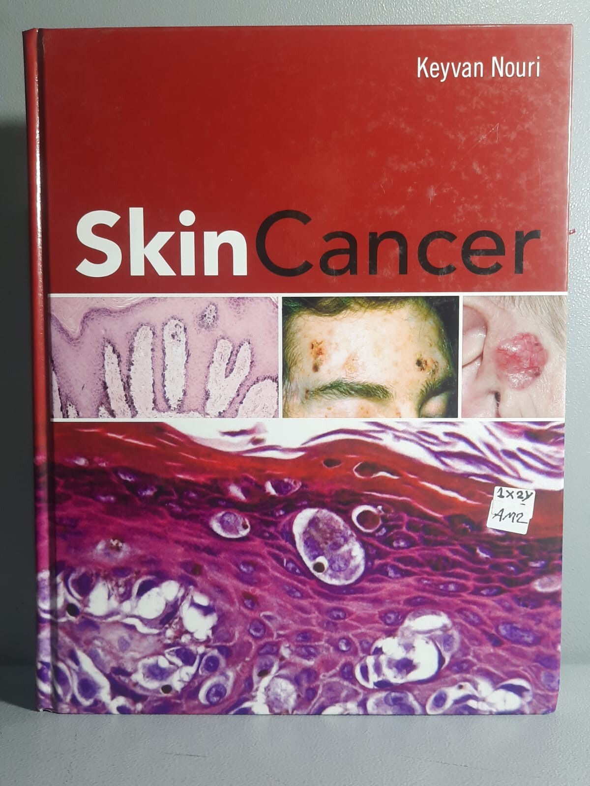 Skin Cancer Keyvan Nouri ISBN 9780071472562