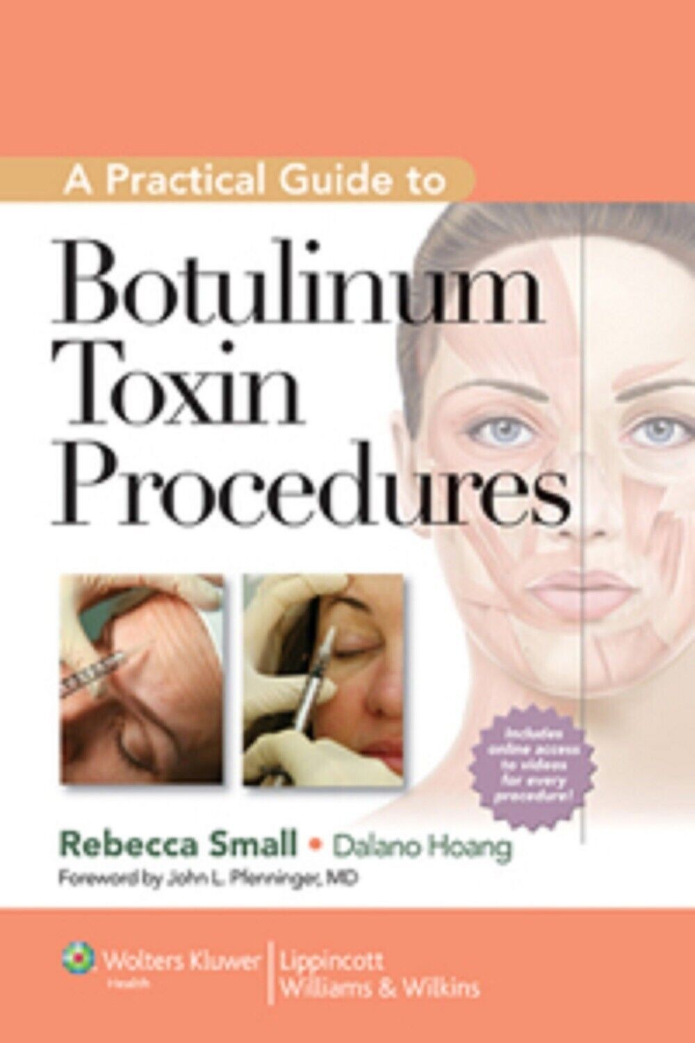 Botulinum Toxin Procedures Hardcover i547
