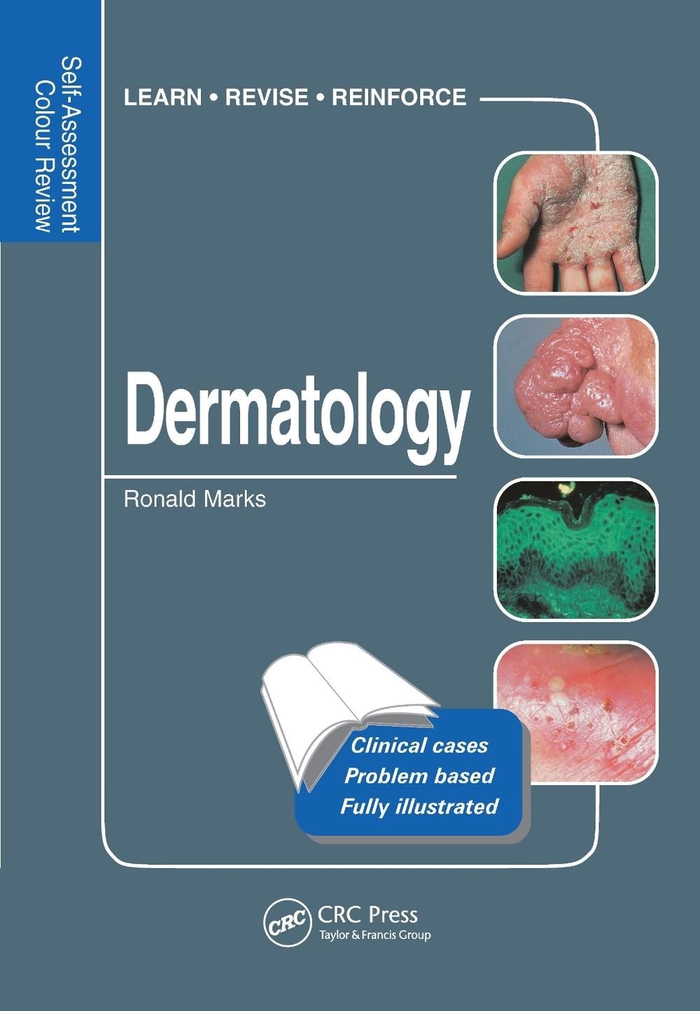 Dermatology: Self-Assessment Colour Review by Ronald Marks (English) Paperback B