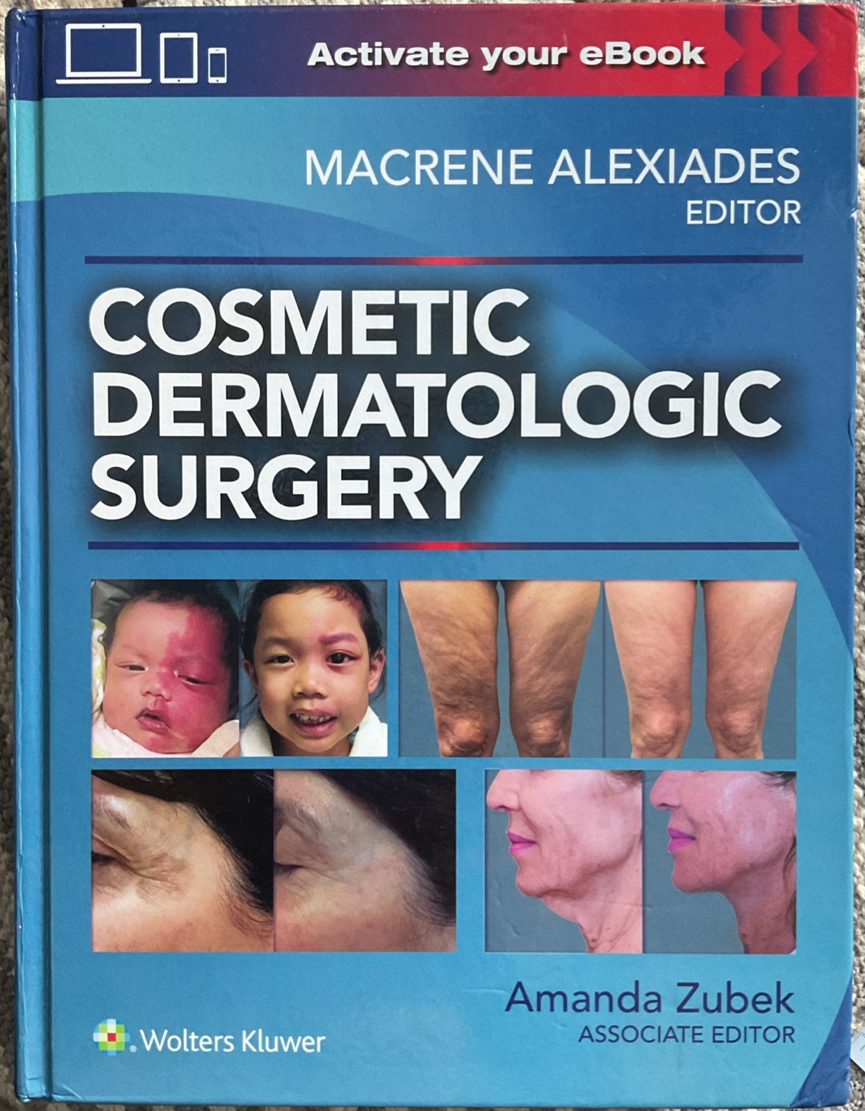 Cosmetic Dermatologic Surgery by Macrene Alexiades (English) Hardcover Book