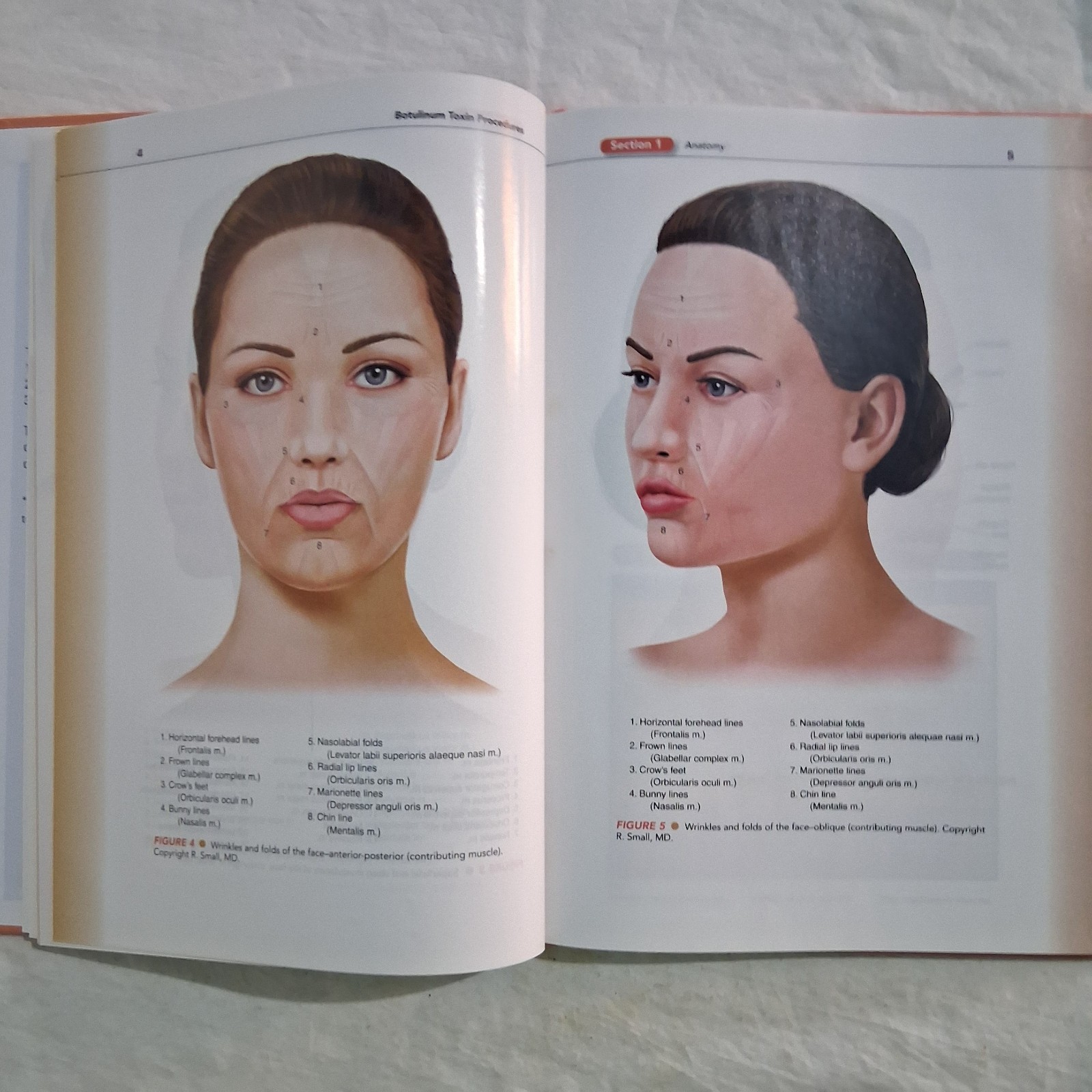 A Practical Guide to Botulinum Toxin Procedures Cosmetic HC