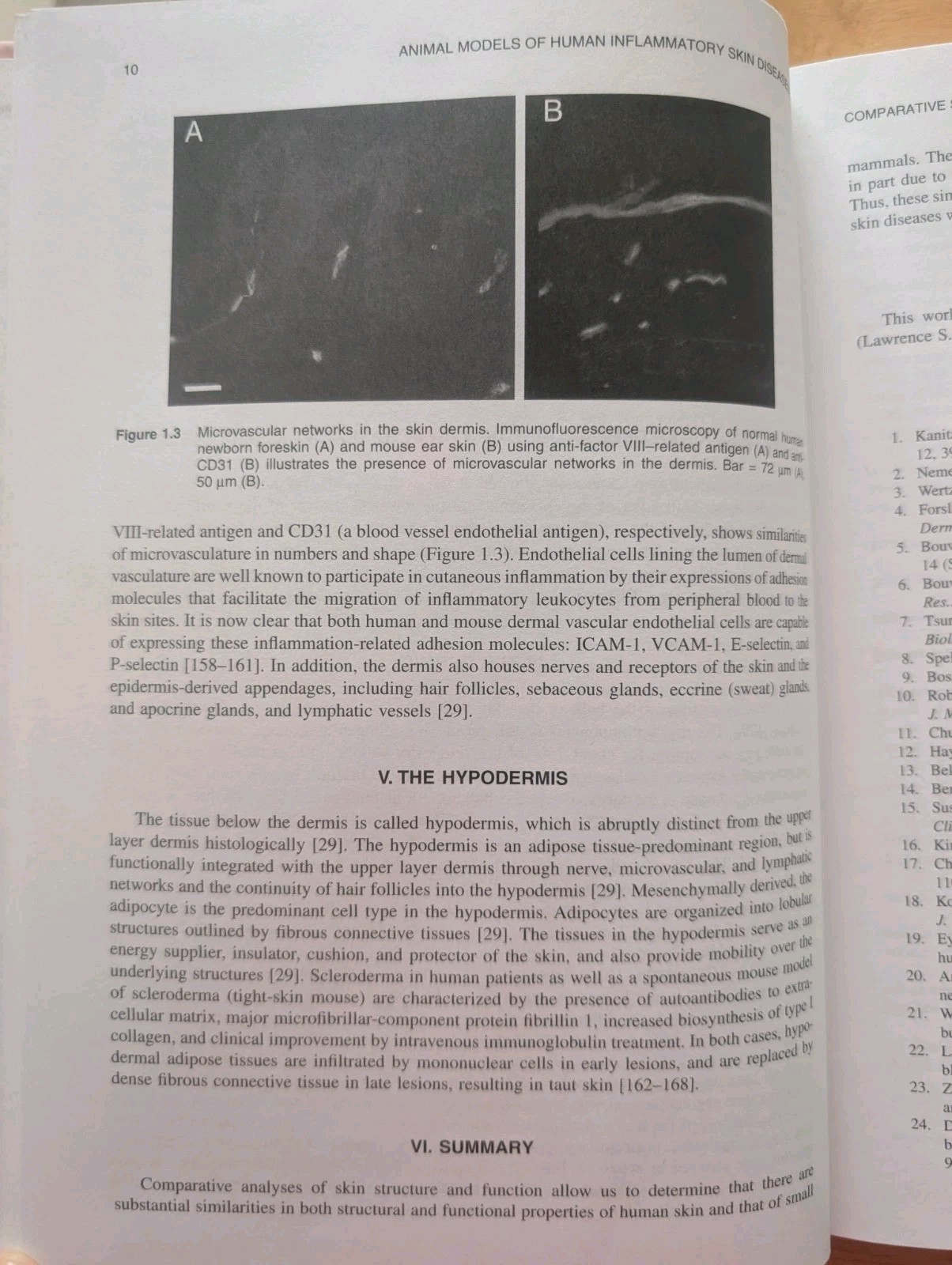 Animal Models of Human Inflammatory Skin Diseases by Lawrence S. Chan (2004)