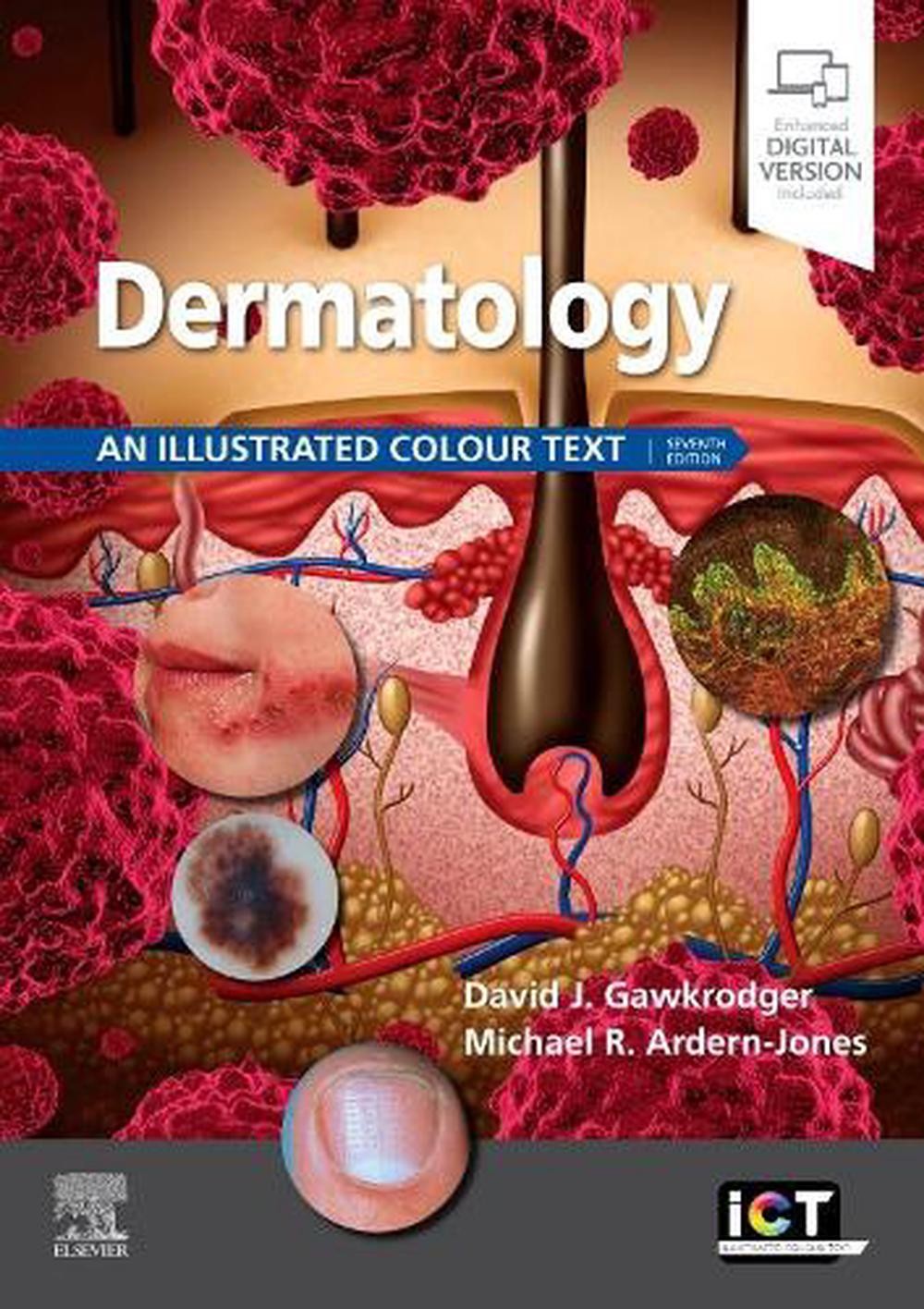 Dermatology: An Illustrated Colour Text 7th Edition by David Gawkrodger (English
