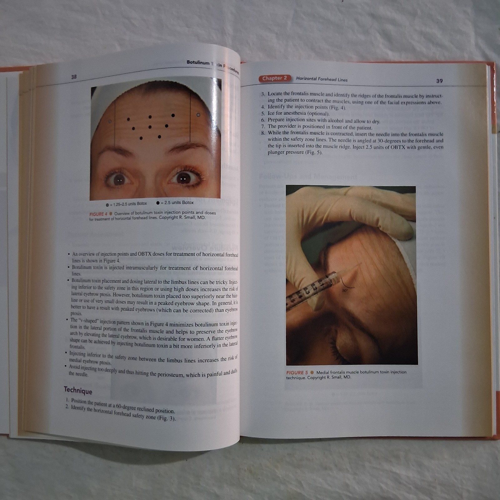 A Practical Guide to Botulinum Toxin Procedures Cosmetic HC