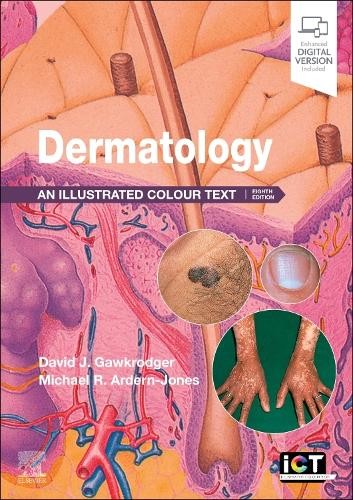 David Gawkrodger Michael R. Ardern-Jones Dermatology (Paperback) (UK IMPORT)