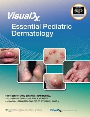 VISUALDX: ESSENTIAL PEDIATRIC DERMATOLOGY (VISUALDX: THE By Goldsmith Md Lowell