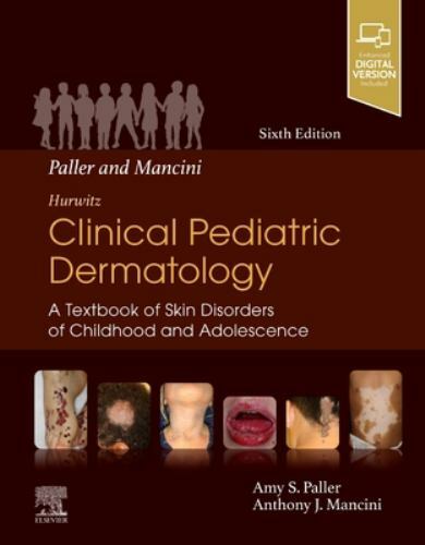 Mancini and Paller – Hurwitz Clinical Pediatric Dermatology : A Textbook of Skin