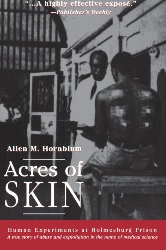 ACRES OF SKIN: HUMAN EXPERIMENTS AT HOLMESBURG PRISON By Allen M. Hornblum *NEW*